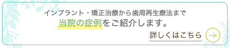 インプラント・矯正治療から歯周再生療法まで当院の症例をご紹介します。