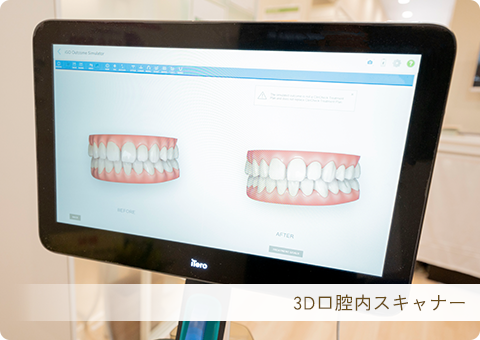 3D口腔内スキャナーiTeroを導入